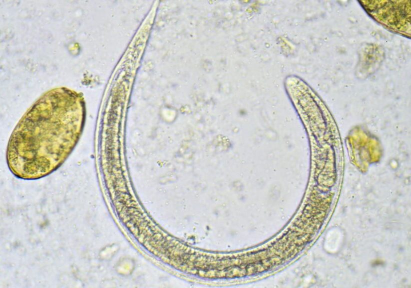 parasite cleanses